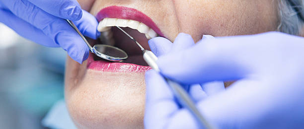 Best Walk-In Emergency Dentist in Smithfield, VA